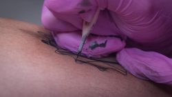 Tattoo Peeling Day by Day: What Is Normal and What Is Not