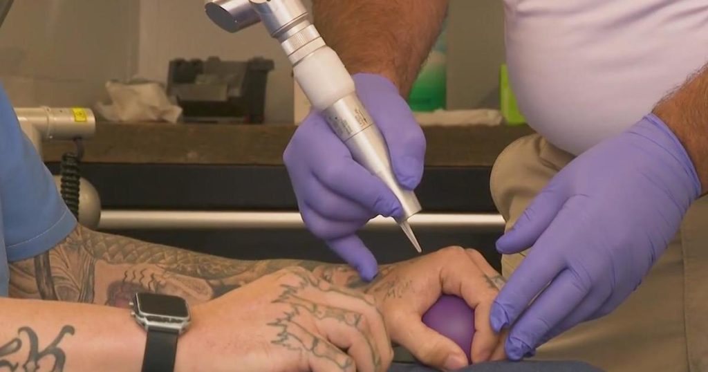 Erasing the past tattoo removal program giving San Quentin inmates