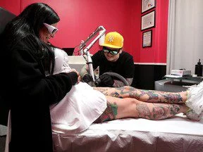 tattoo removal Edmonton Journal